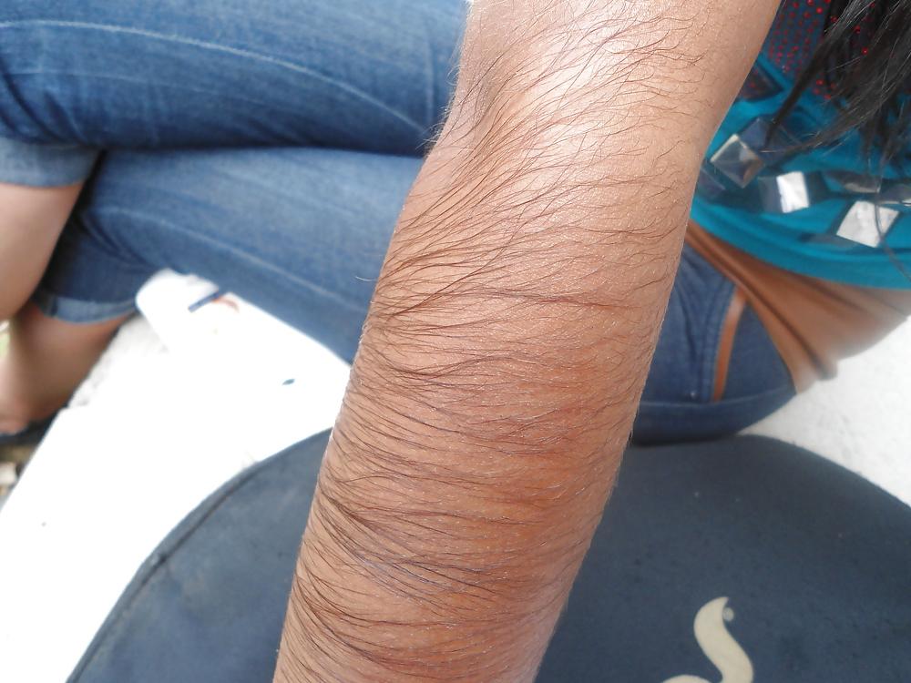 25P Girl with very hairy arms