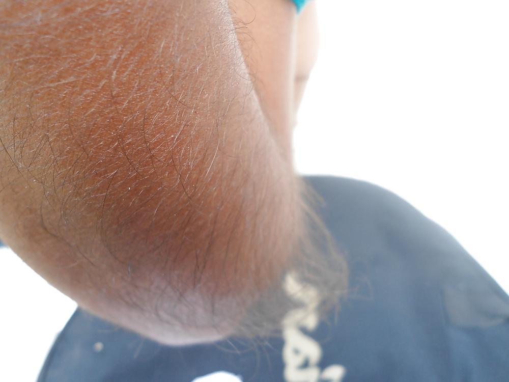 25P Girl with very hairy arms