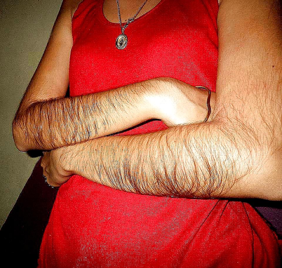 25P Girl with very hairy arms