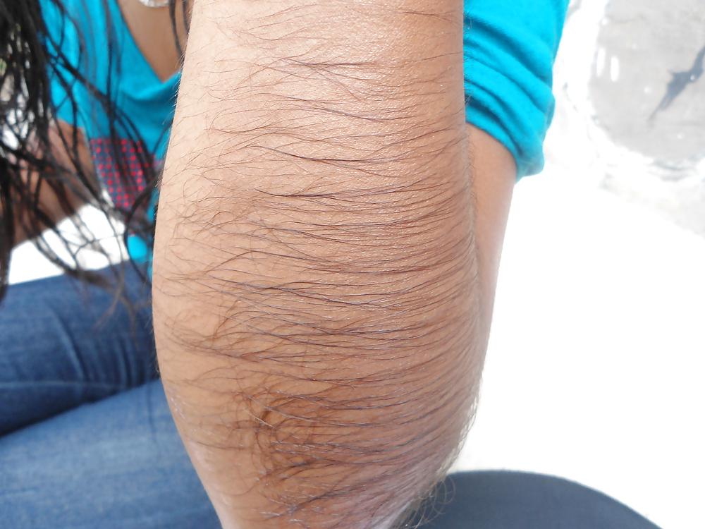 25P Girl with very hairy arms
