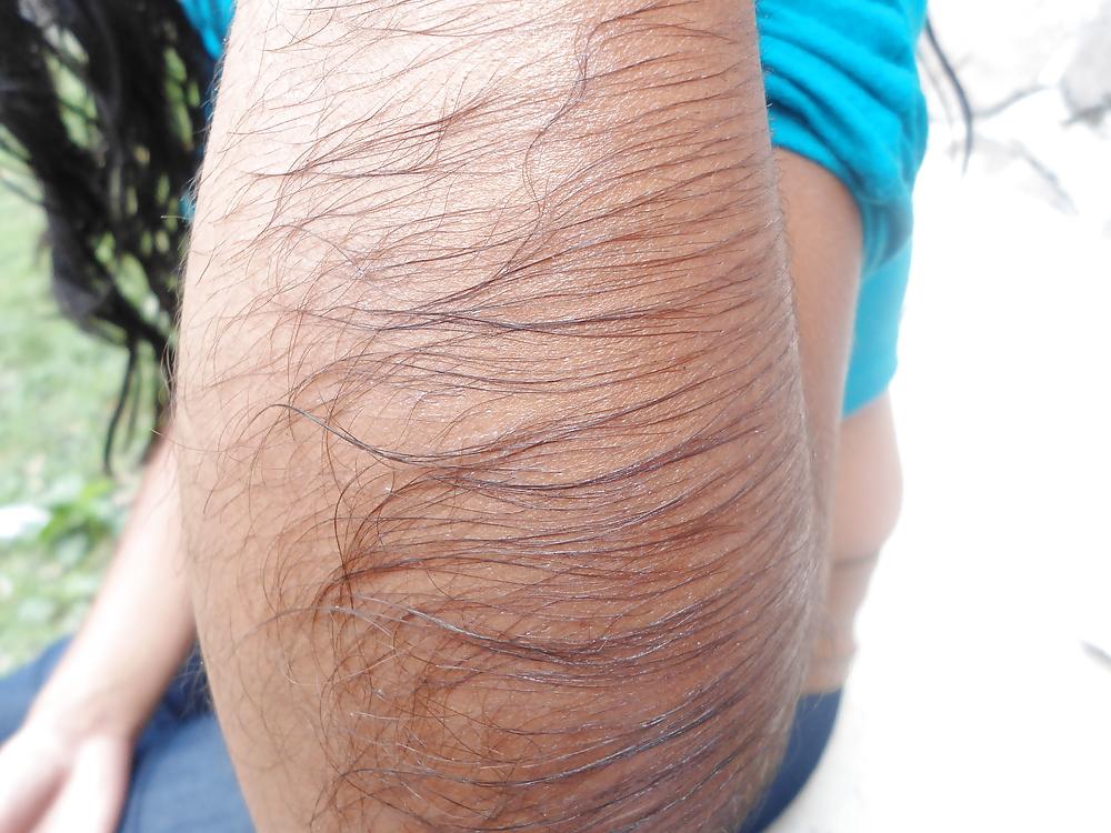25P Girl with very hairy arms
