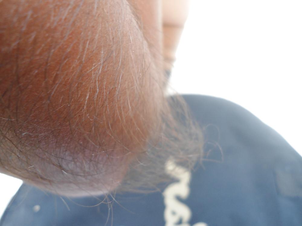 25P Girl with very hairy arms