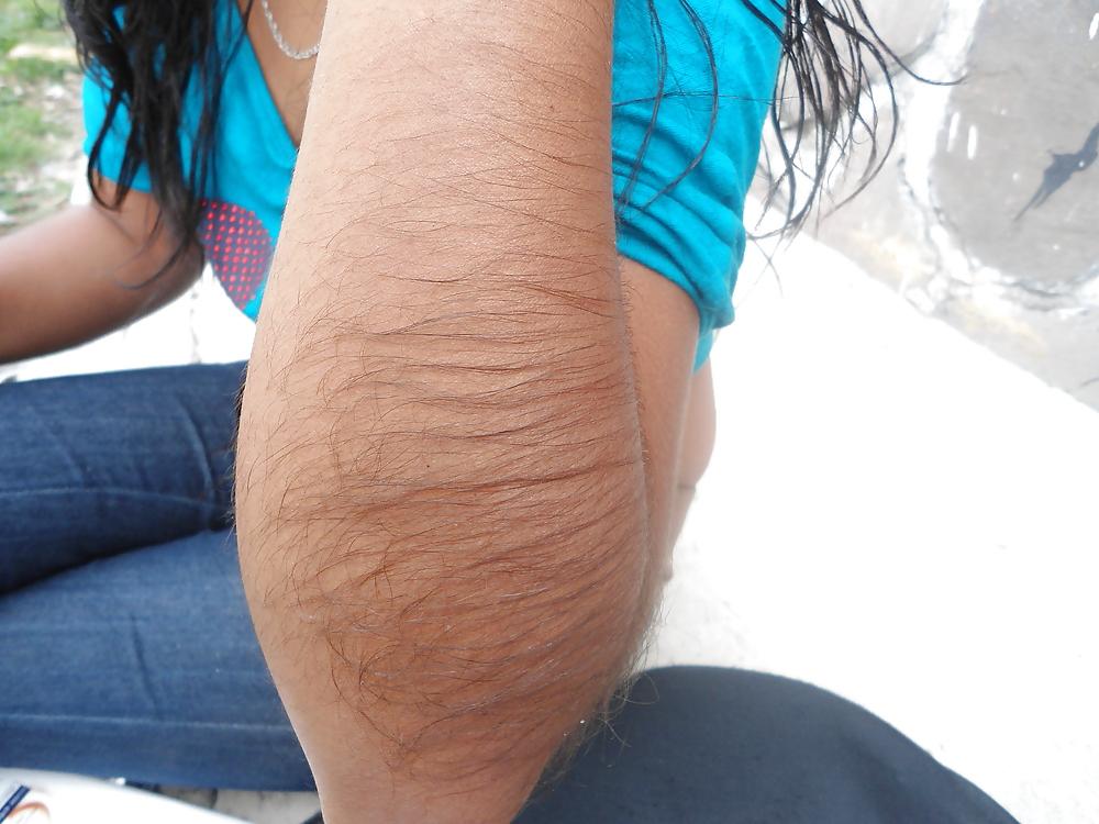 25P Girl with very hairy arms