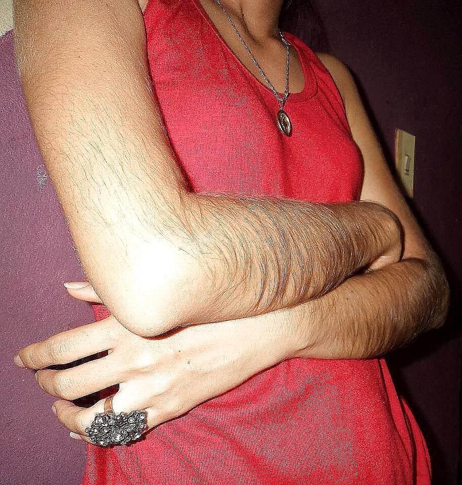 25P Girl with very hairy arms