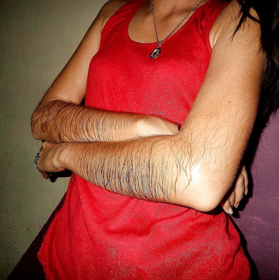25P Girl with very hairy arms