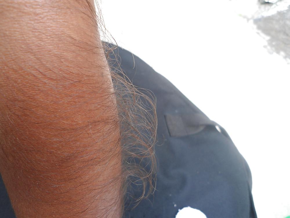 25P Girl with very hairy arms
