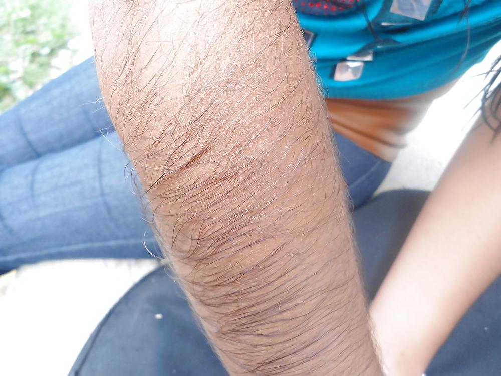 25P Girl with very hairy arms