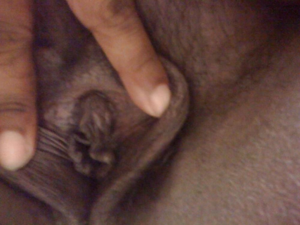 22P Fatt hairy pussy