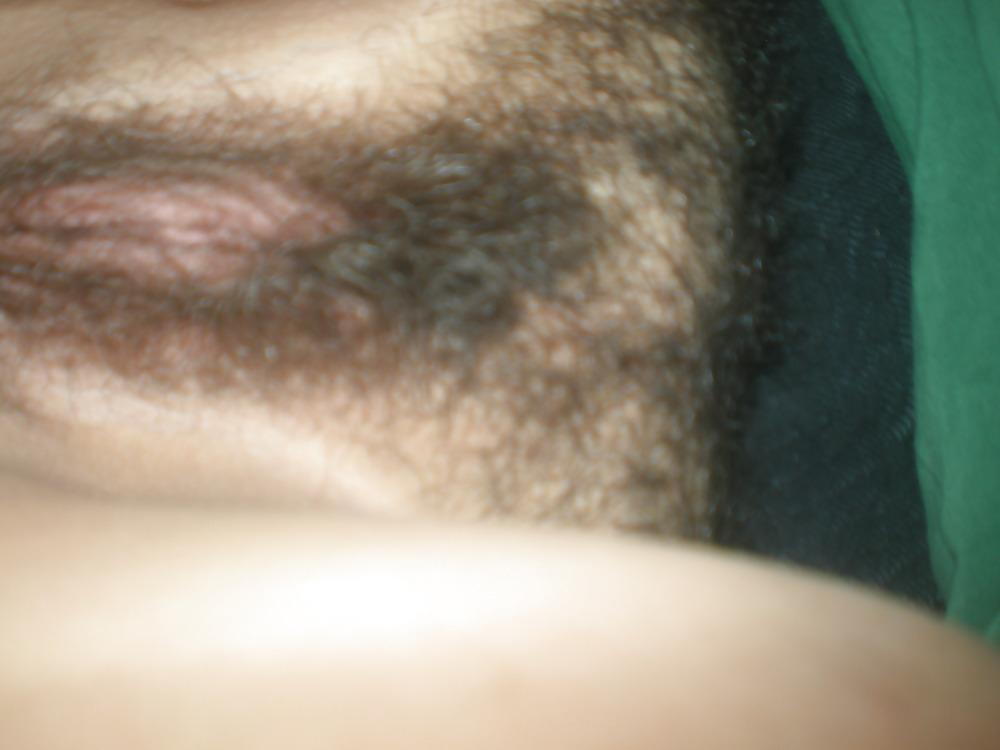5P Hairy bush