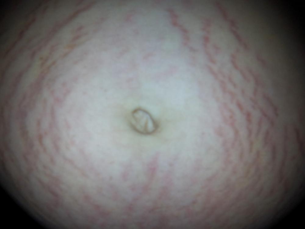 18P Prego Huge Areola Woman