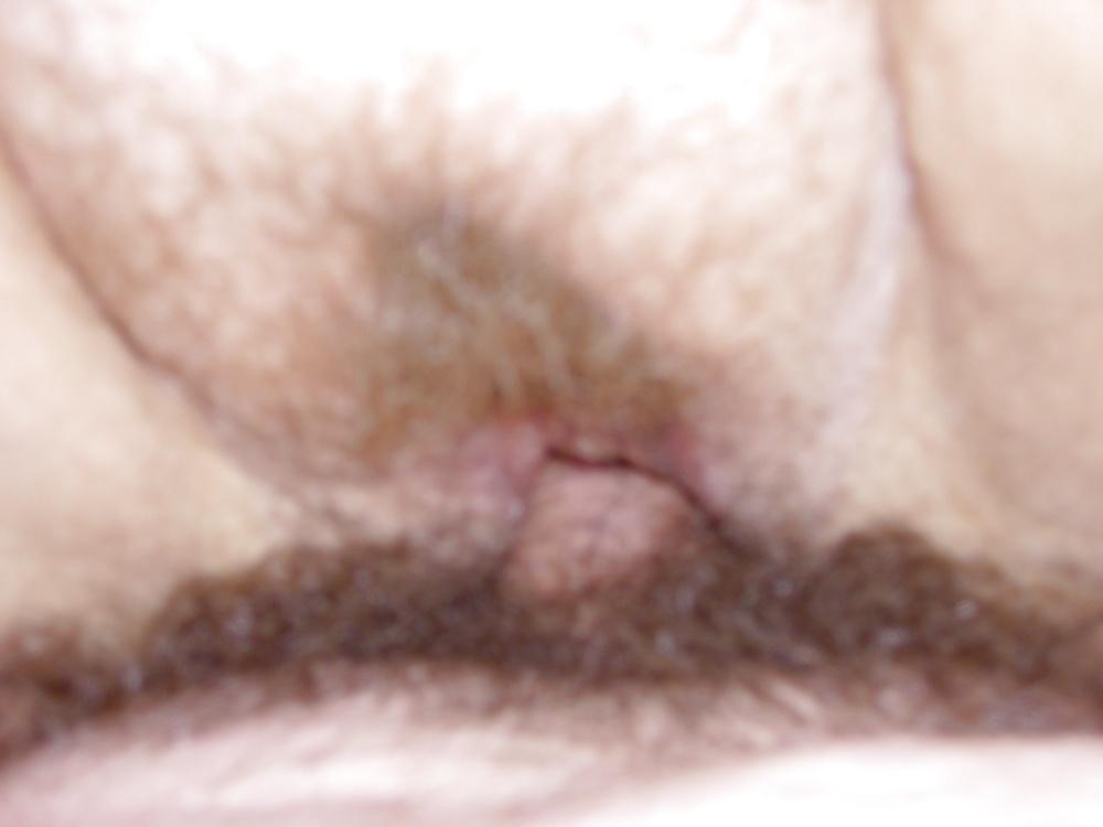 14P Collar Redux