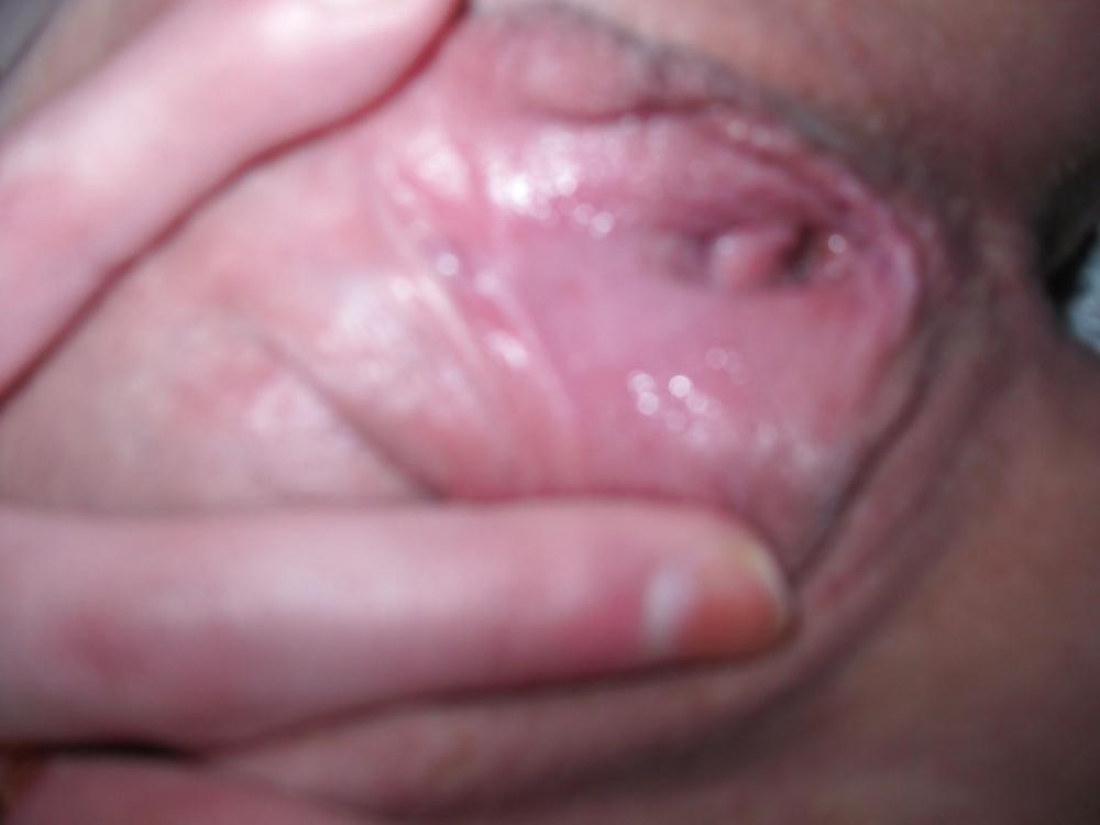 17P Scottish Jen Spreads Her Pussy