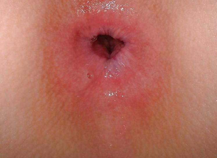 20P Japanese Mature Woman 127