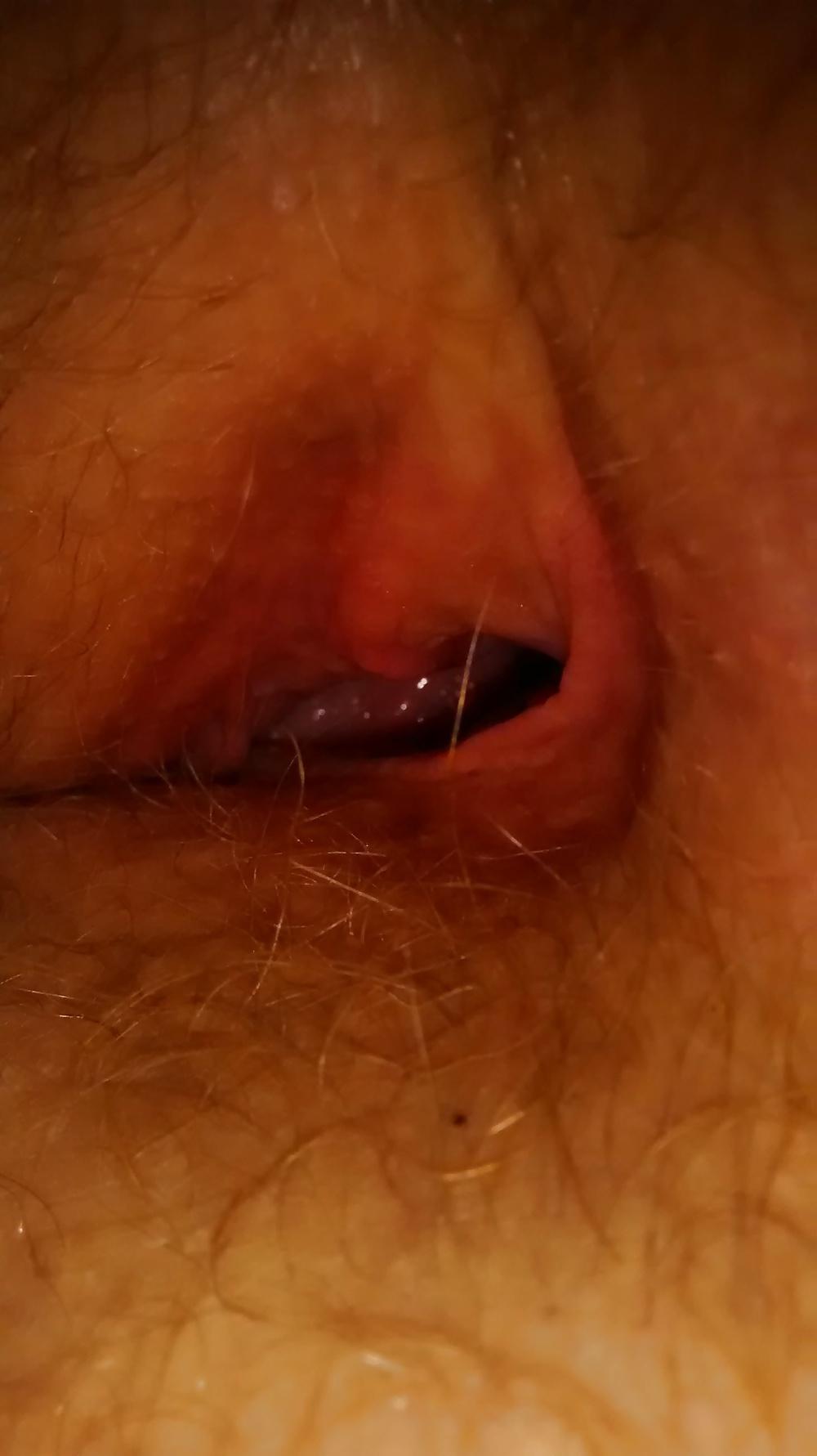 4P Gf hairy bush 