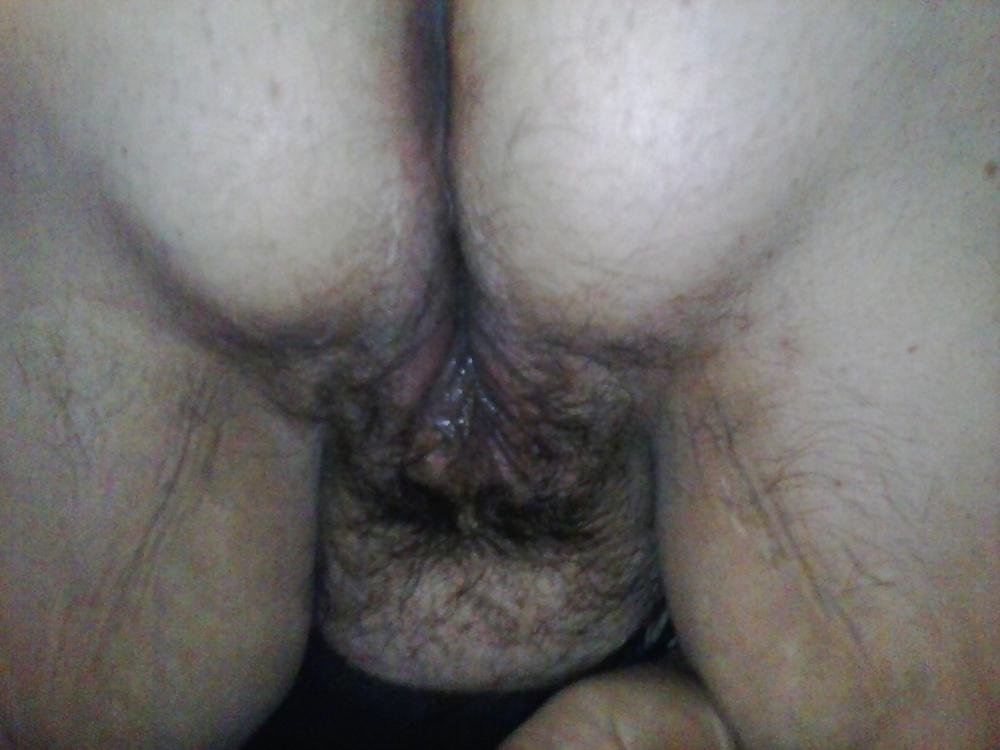 7P New hairy bush