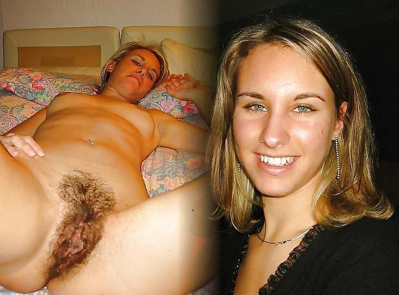 22P Another Hairy collection #23