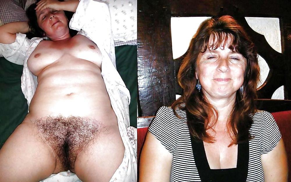 22P Another Hairy collection #23