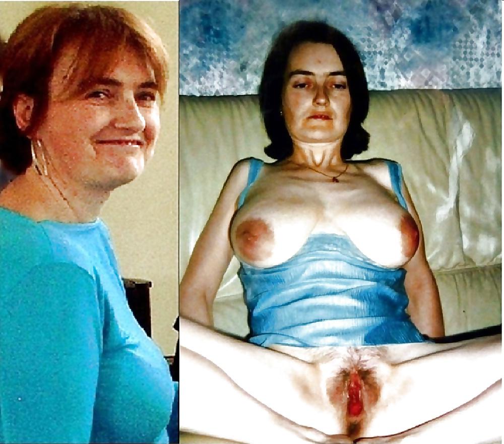 25P Dressed - Undressed - vol 32!