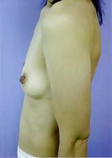 20P Japanese Mature Woman 142