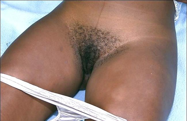 24P Revealing a hairy pussy