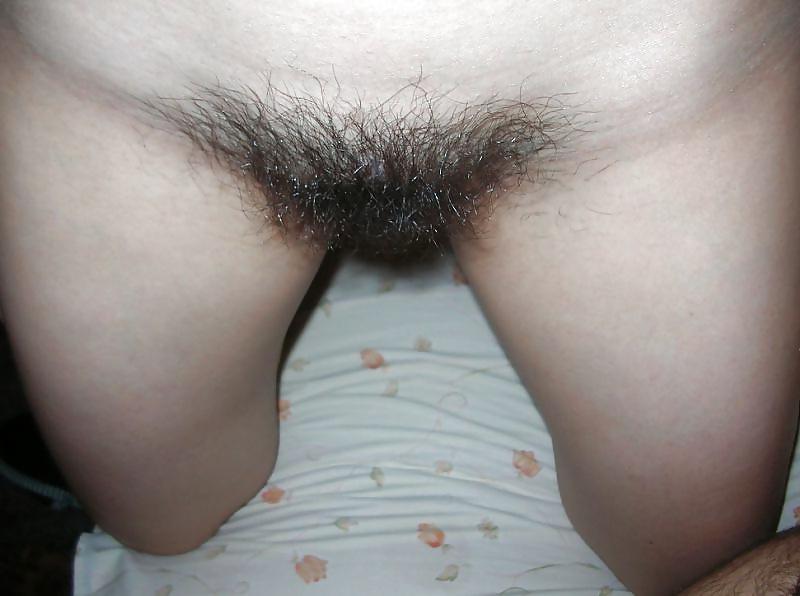 25P Hairy Amateur Closeups