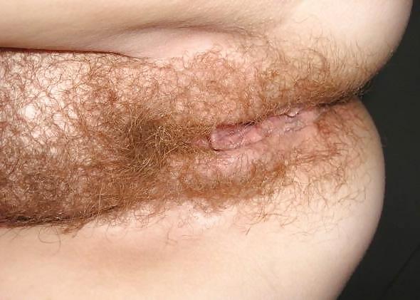 25P Another Hairy collection #24
