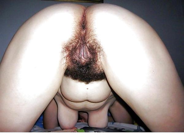 20P Hairy girls and women 23
