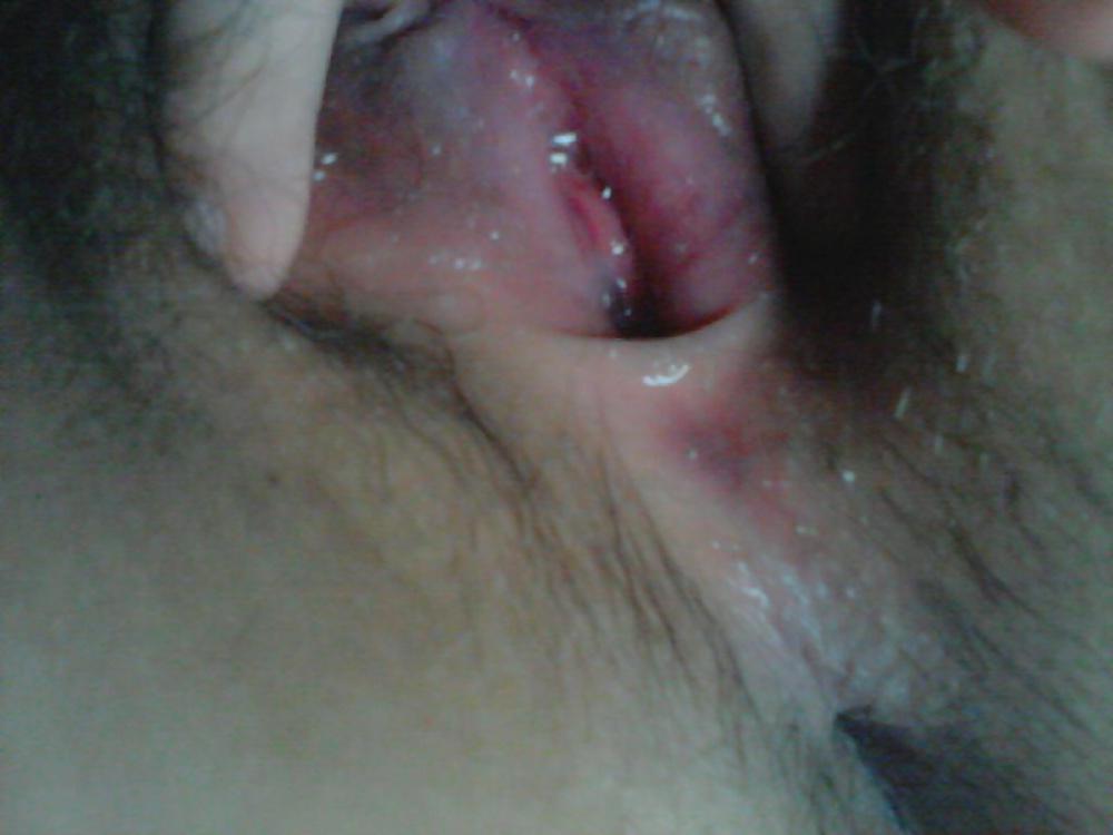 25P Korean milf pussy