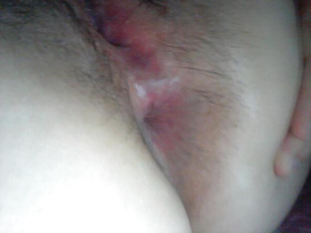 25P Korean milf pussy