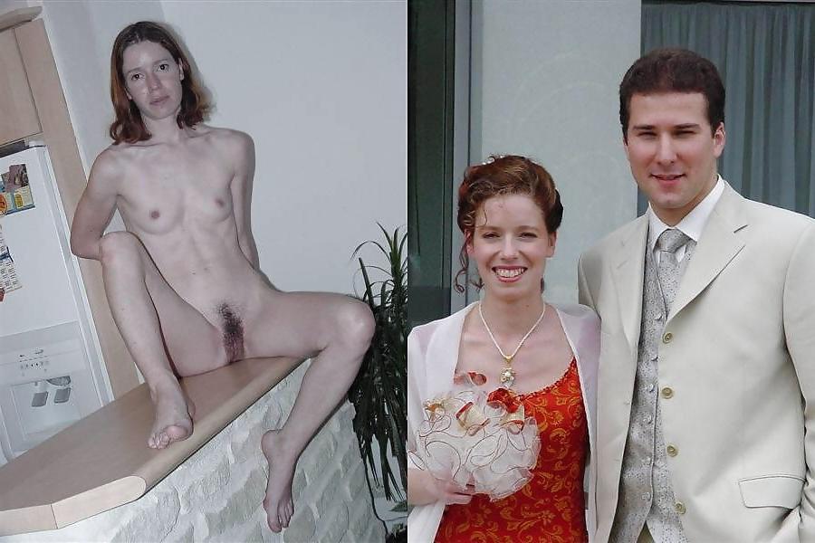 20P Before after 250 (young girl special).