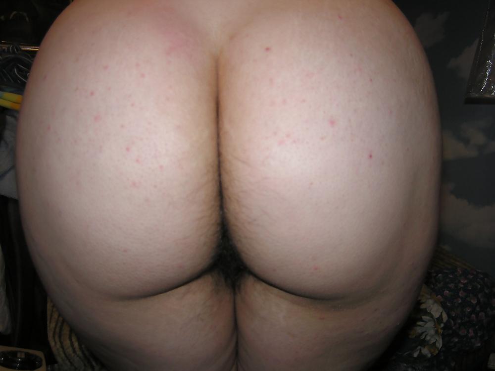 12P Hairy ass (part 3)