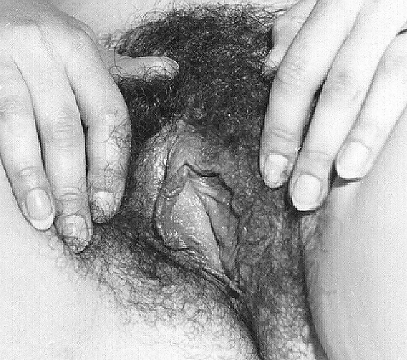5P Some bw photos of hairy woman