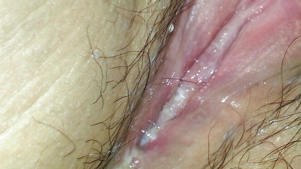 20P Korean milf pussy