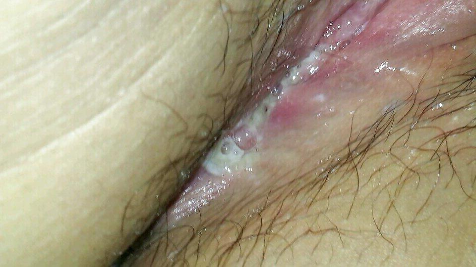 20P Korean milf pussy