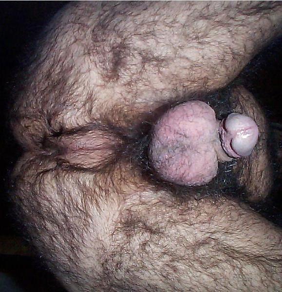 17P Hairy Husband