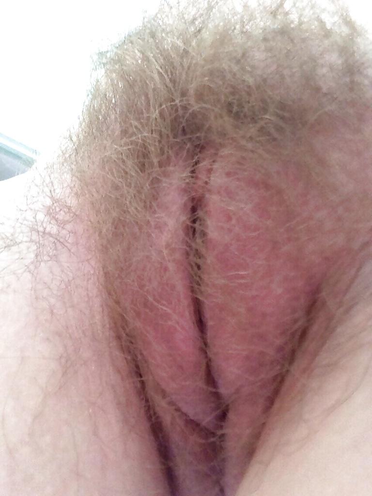20P Hairy Pussy