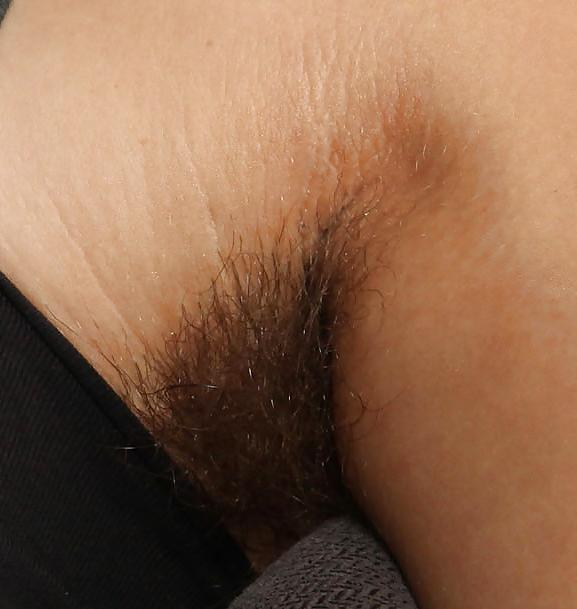 25P Hairy armpits 3