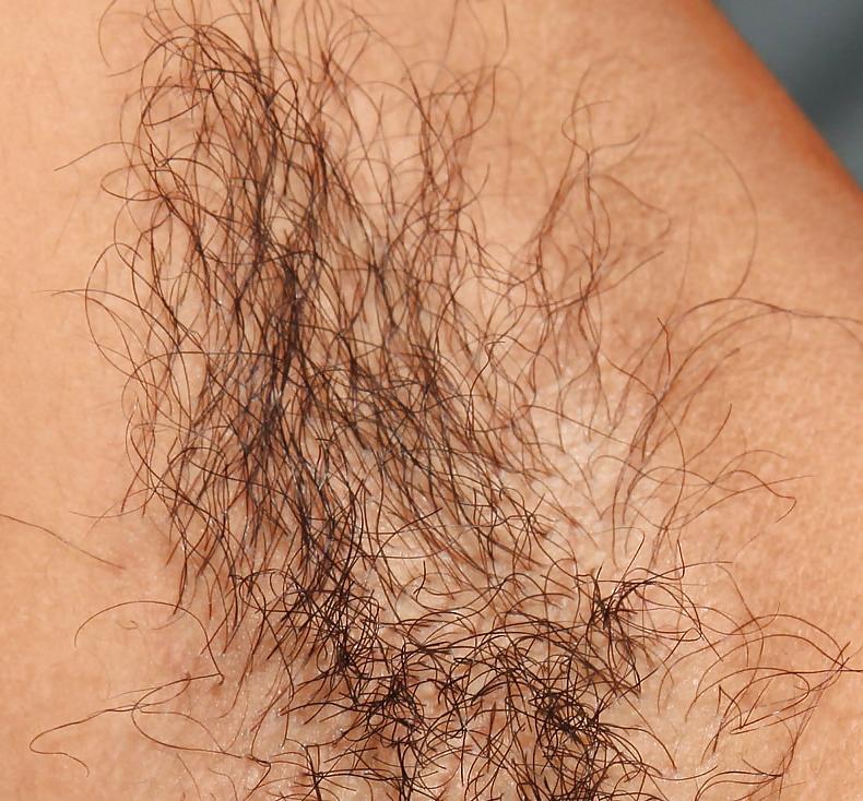 25P Hairy armpits 3