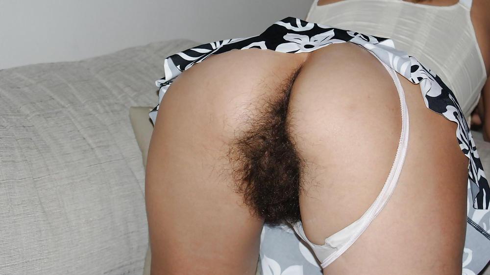 10P Hairy 17