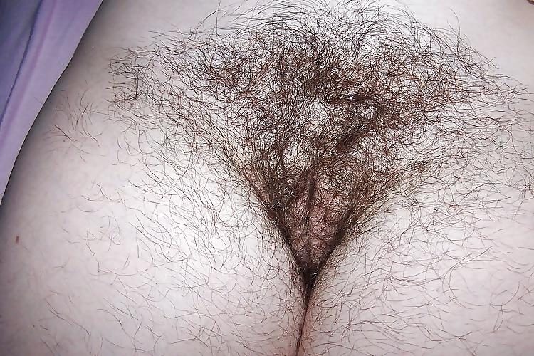 20P Mature hairy wife