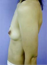 20P Japanese Mature Woman 142