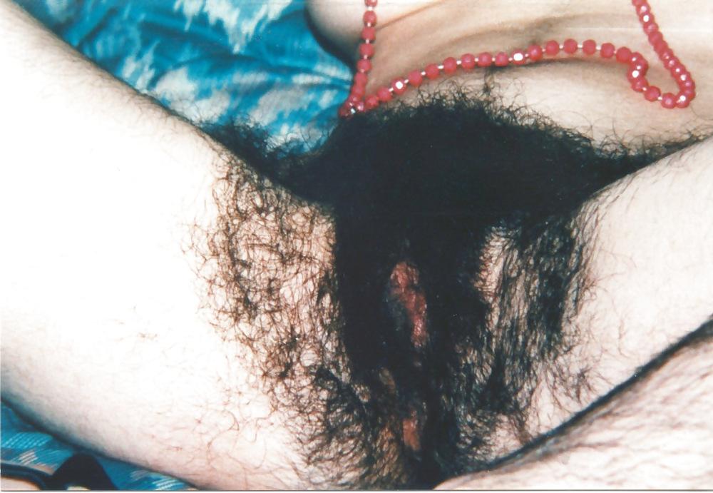 7P Hairy Leslie