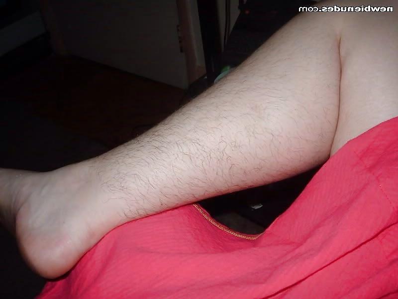 25P Hairy