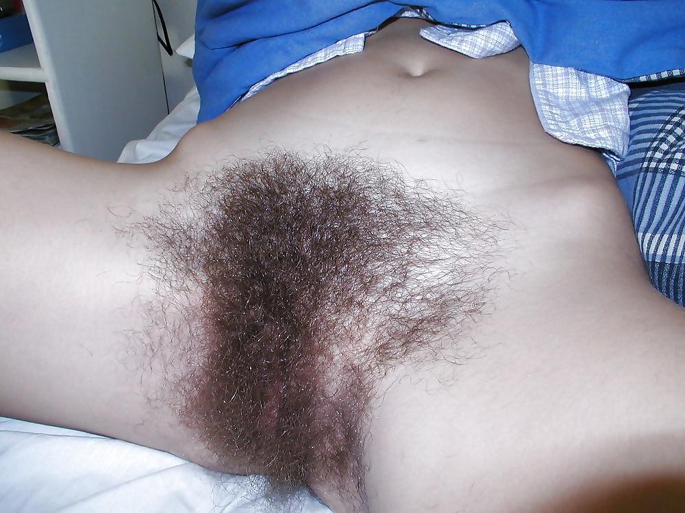 25P Hairy