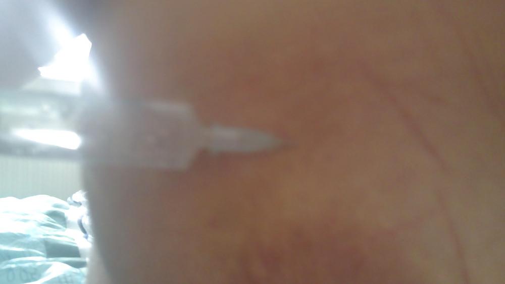6P Scottish slut self harm