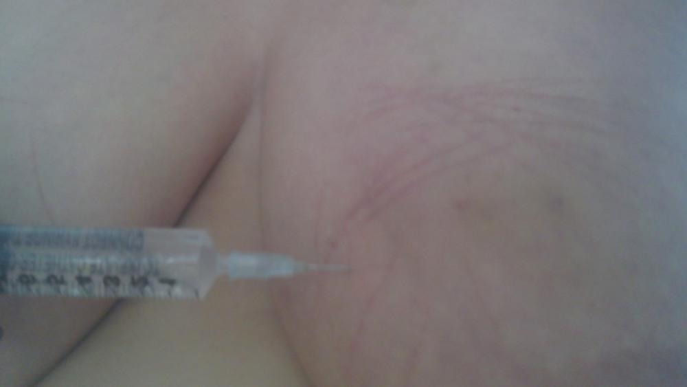 6P Scottish slut self harm
