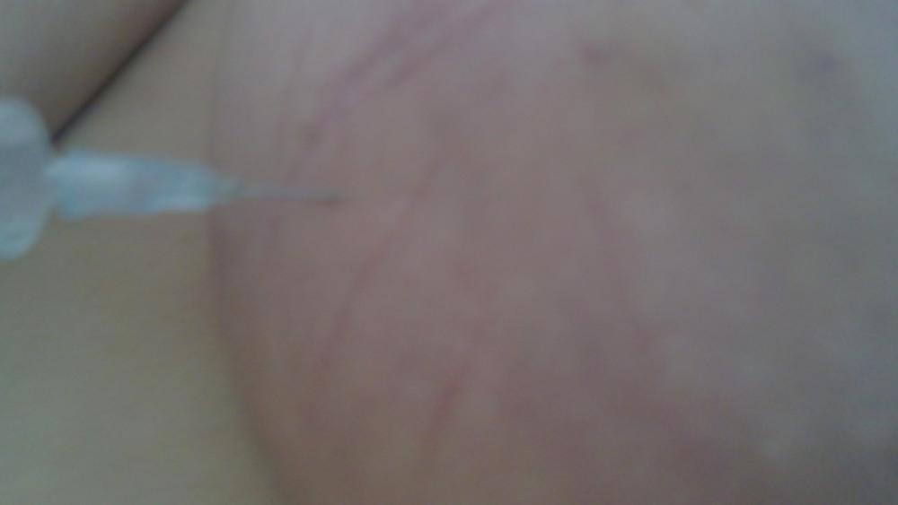 6P Scottish slut self harm