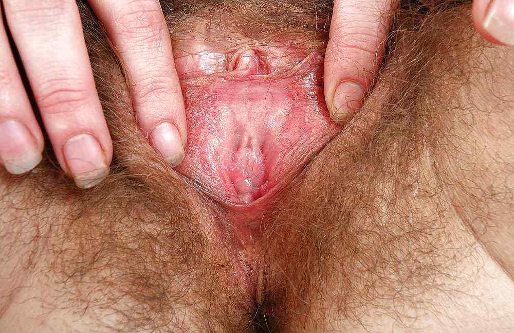 25P SeXy Hairy Mature #1 by DarKKo