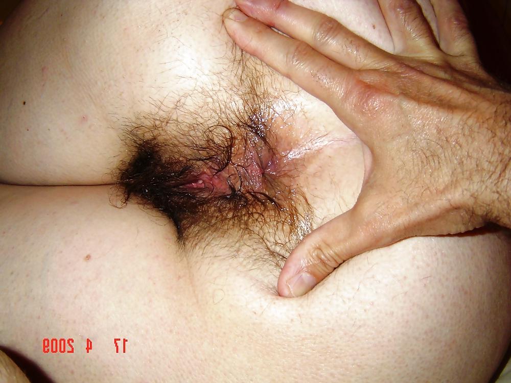 25P Hairy mature 