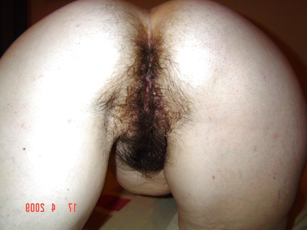 25P Hairy mature 